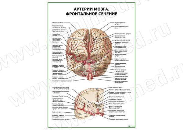  Артерии мозга. Фронтальное сечение плакат матовый/ламинированный А1/А2 