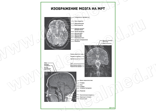  Изображение мозга на МРТ плакат матовый/ламинированный А1/А2 