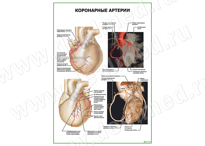  Коронарные артерии плакат матовый/ламинированный А1/А2 