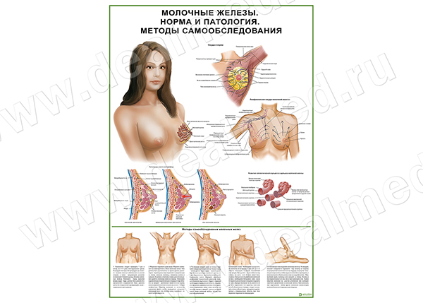 Молочные железы, мастопатия, самообследование, плакат матовый/ламинированный А1/А2