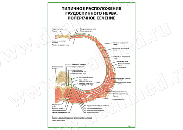  Типичное расположение грудоспинного нерва. Поперечное сечение плакат матовый/ламинированный А1/А2 