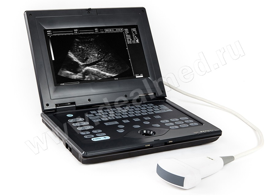 Портативный УЗИ сканер AcuVista RS880c, Китай