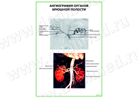 Ангиография органов брюшной полости плакат матовый/ламинированный А1/А2