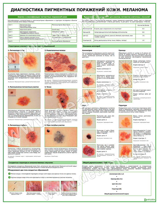 Меланома. Диагностика, плакат матовый/ламинированный А1/А2