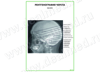 Рентгенография черепа. Вид сбоку плакат матовый/ламинированный А1/А2