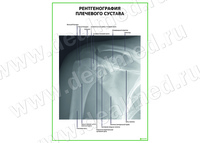 Рентгенография плечевого сустава плакат матовый/ламинированный А1/А2