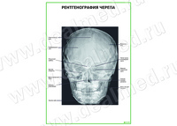 Рентгенография черепа плакат матовый/ламинированный А1/А2