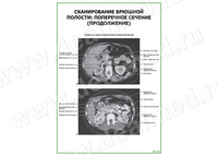Сканирование брюшной полости: поперечное сечение (продолжение) плакат матовый/ламинированный А1/А2