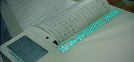 Cardioline