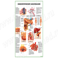 Онкологические заболевания плакат матовый/ламинированный А1/А2