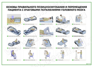 Основы правильного позиционирования и перемещения пациента с очаговыми поражениями головного мозга плакат матовый/ламинированный А1/А2