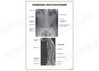 Позвонок. Рентгенография плакат матовый/ламинированный А1/А2