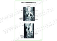 Рентгенография таза плакат матовый/ламинированный А1/А2