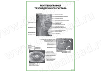 Рентгенография тазобедренного сустава плакат матовый/ламинированный А1/А2