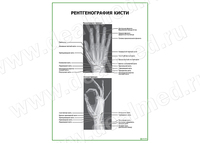 Рентгенография кисти плакат матовый/ламинированный А1/А2