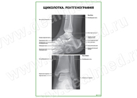 Щиколотка. Рентгенография плакат матовый/ламинированный А1/А2