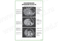 Сканирование брюшной полости плакат матовый/ламинированный А1/А2