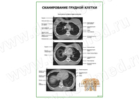 Сканирование грудной клетки плакат матовый/ламинированный А1/А2