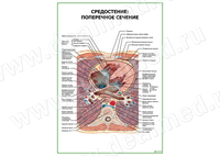 Средостение поперечное сечение плакат матовый/ламинированный А1/А2