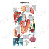 Вред алкоголя плакат матовый/ламинированный А1/А2